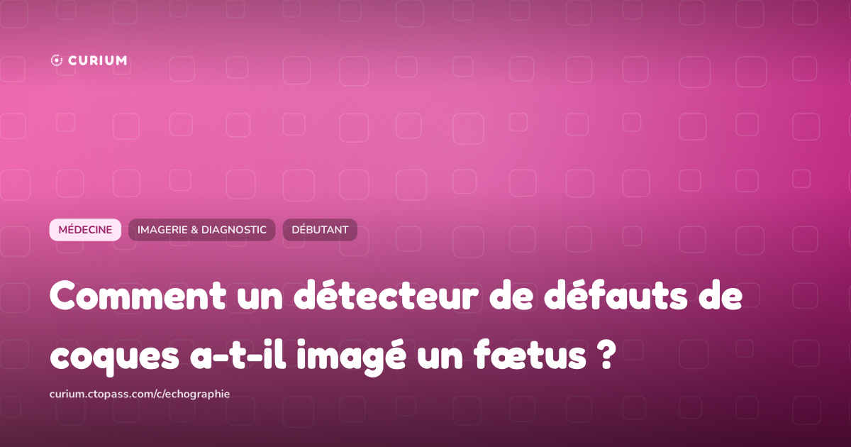 Comment un détecteur de défauts de coques a-t-il imagé un fœtus ?